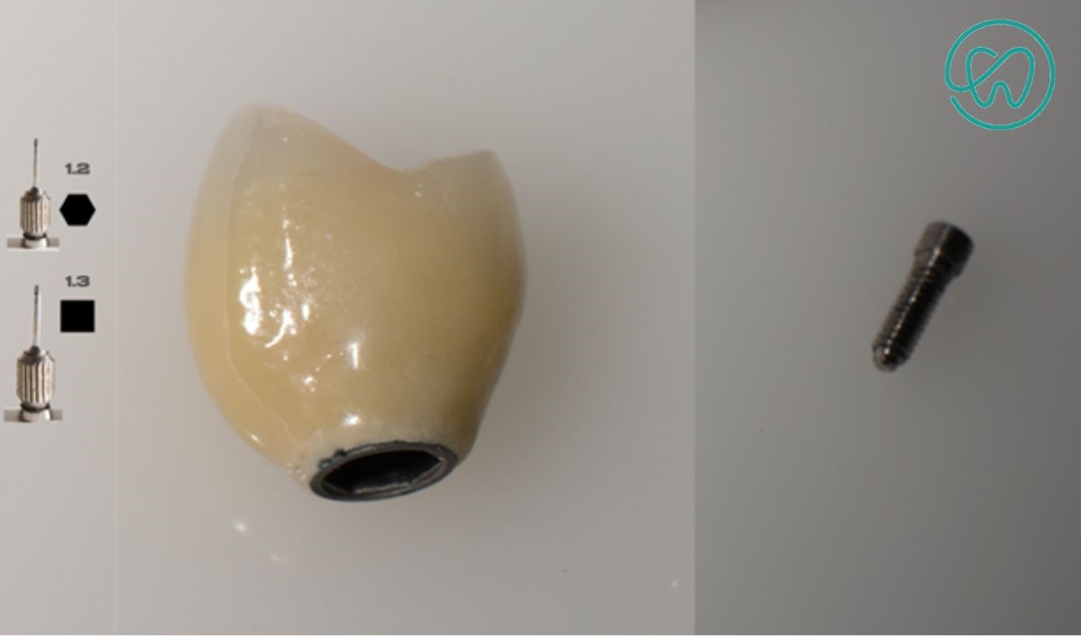 parafuso para estabilidade da coroa em implante dentário